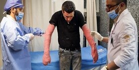 اورژانس کشور به افزایش فوتی‌ها و زخمی‌های چهارشنبه سوری هشدار داد