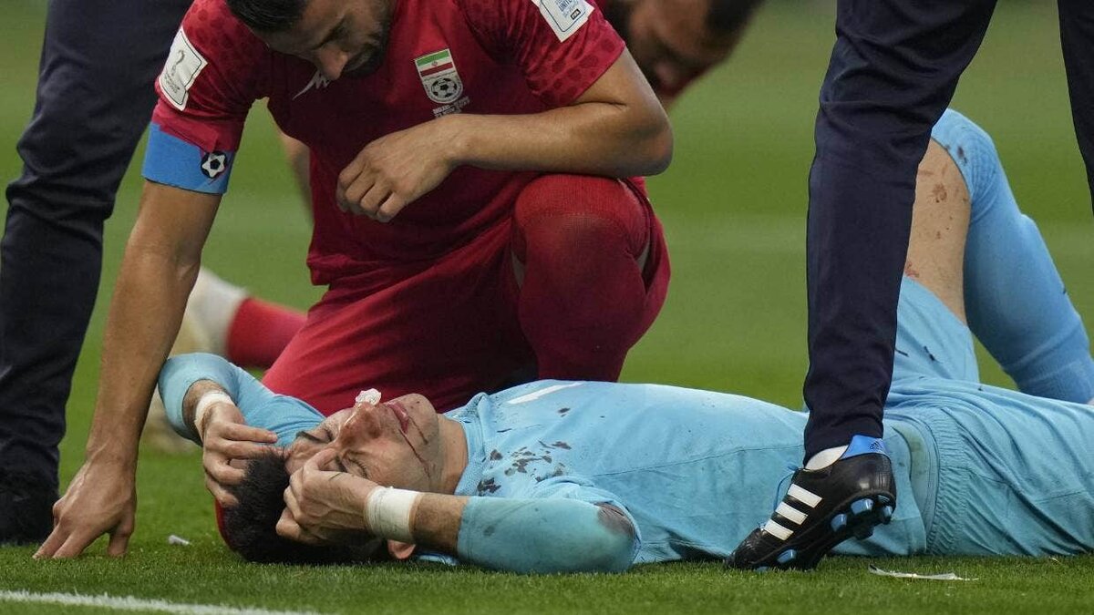 بیرانوند در دربی برای پرسپولیس بازی میکند؟