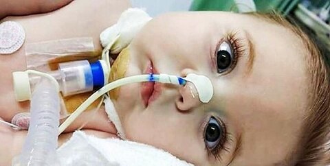 درمان رایگان کودکان مبتلا به هافمن در دولت سیزدهم محقق شد بیماری