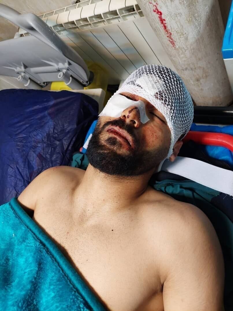 تصویری از مدافع ملی‌پوش بعد از تصادف شدید در جاده شمال