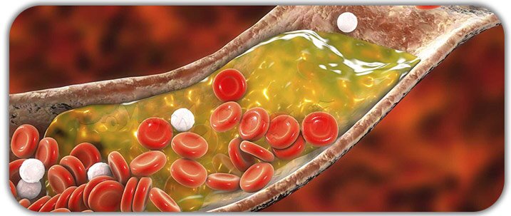 بهترین راه کاهش چربی خون