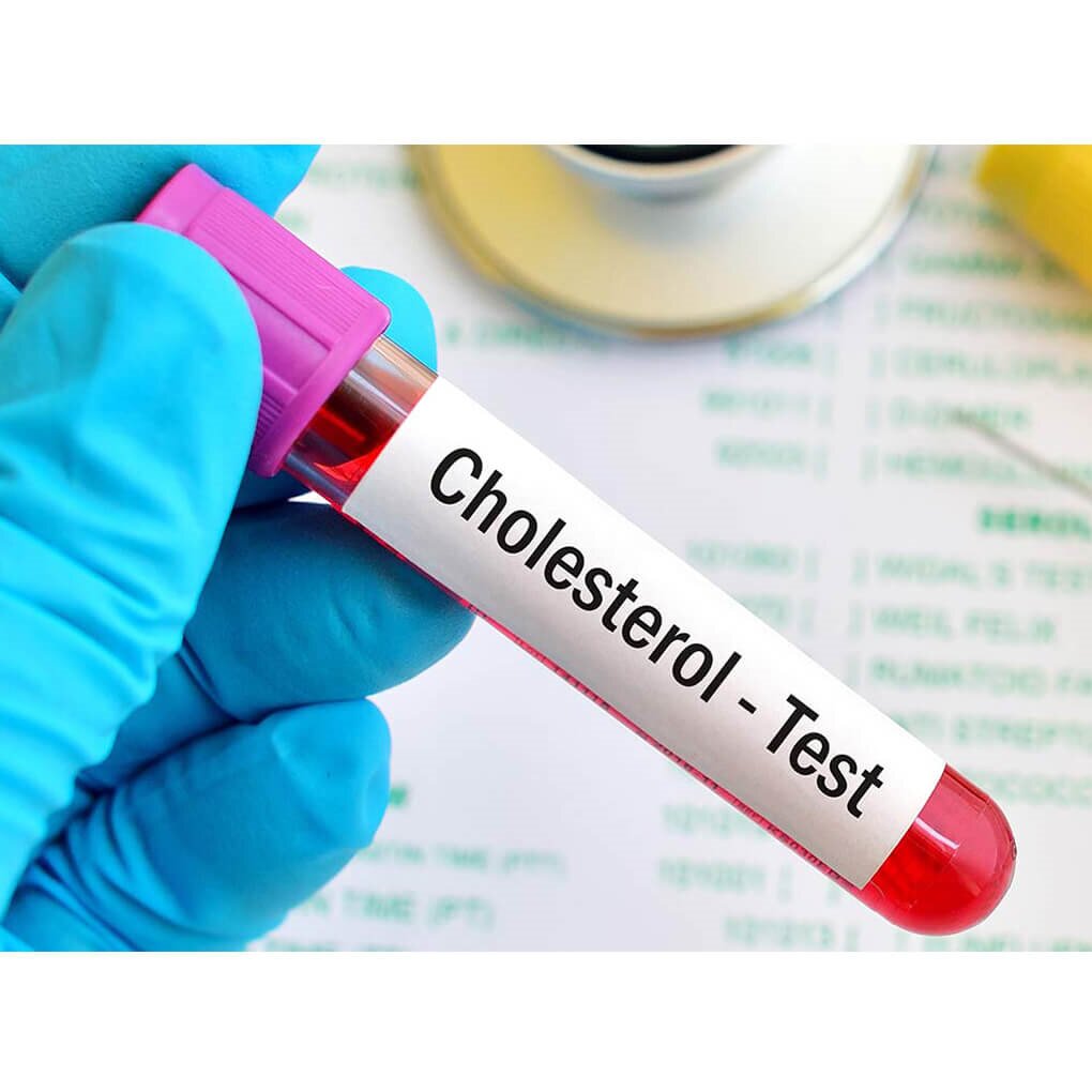 بهترین راه کاهش چربی خون