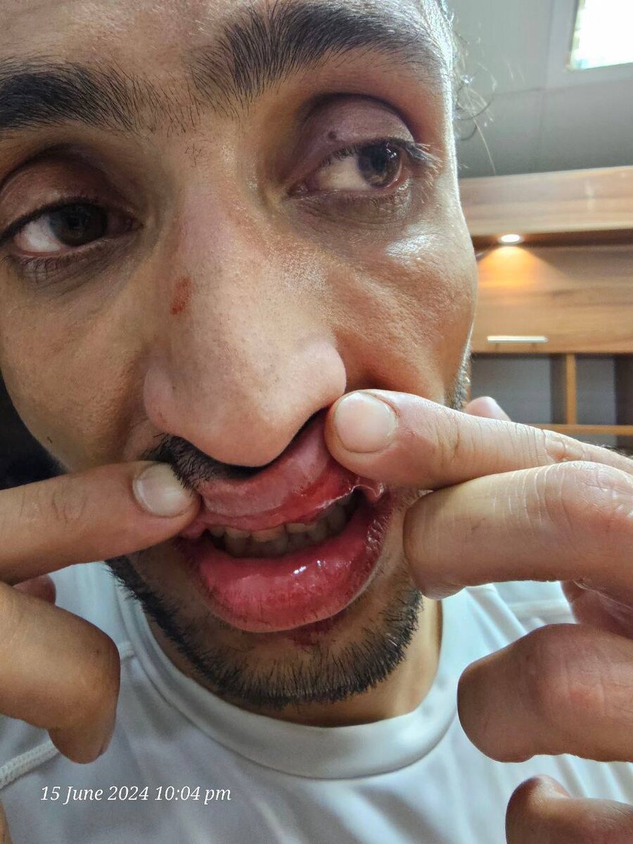 تبعات درگیری در پایان دیدار/ گلگهریها، مدافع و مترجم سپاهان را مصدوم کردند