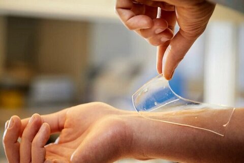 انقلابی در درمان زخمهای دیابتی و سوختگی با پانسمانهای هوشمند شبیه پوست فناوری