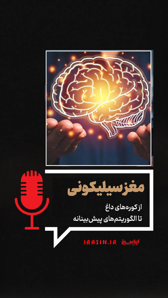 مغز سیلیکونی